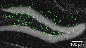 Zika may harm grown-up brains