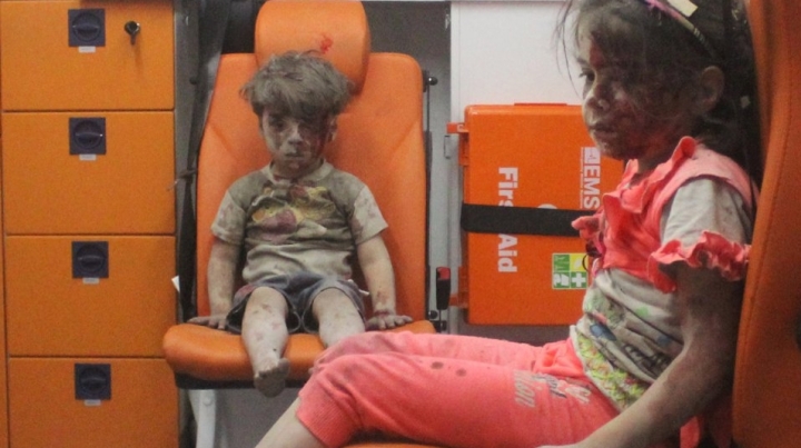 Russia declines responsibility in injuring 5-year-old Syrian, whose photo went viral