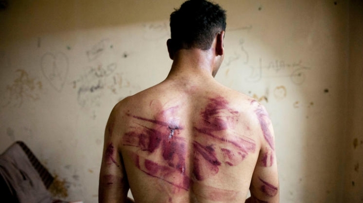 'Licking water from the floor like cats!' Report reveals horrible detention conditions in Syria's jails