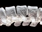 Superflexible, 3-D printed “bones” brace for breakthrough in medicine