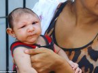 Zika virus causes not only microcephaly. Other illnesses are appalling, too  