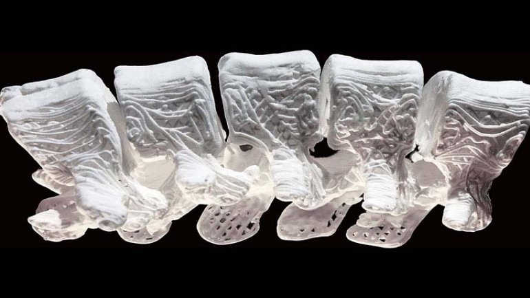 Superflexible, 3-D printed “bones” brace for breakthrough in medicine