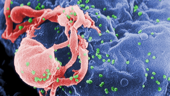 UK scientists announce breakthrough in curing HIV