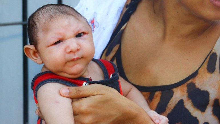 Zika virus causes not only microcephaly. Other illnesses are appalling, too  