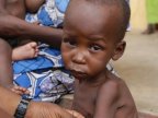  United Nations: 75,000 children in Nigeria could starve to death within months