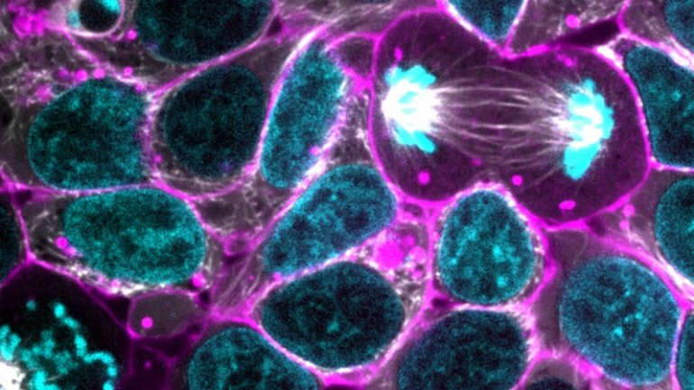 Study: Glowing human cells may shed light on sickness and health