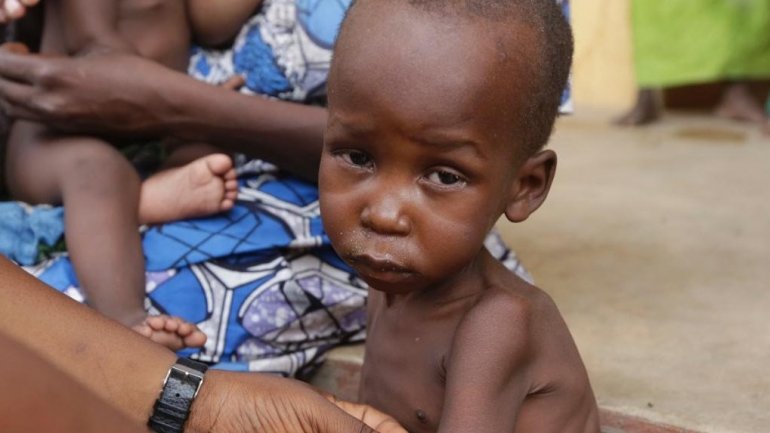  United Nations: 75,000 children in Nigeria could starve to death within months