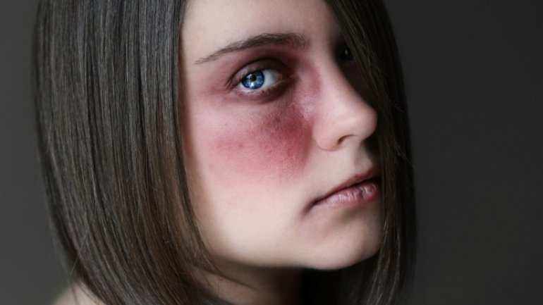 Ten years of Horror! Woman from Moldova, residing in Italy, lived with constant domestic abuse