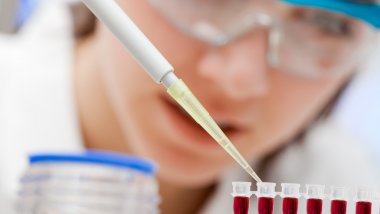 Health: New anti-HIV therapy to inhibit virus in six months