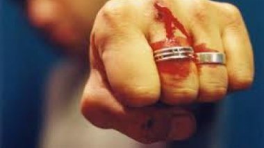 Calarasi district resident BEATEN TO DEATH by two locals