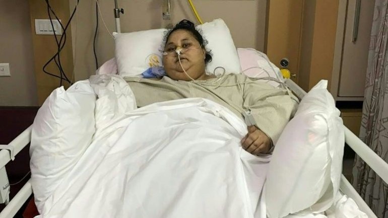 Egyptian woman, considered world's heaviest, successfully operated on in India