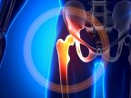 Traumatologist doctors from districts could be instructed by Romanian specialists to do arthroplasty 