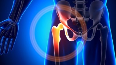 Traumatologist doctors from districts could be instructed by Romanian specialists to do arthroplasty 