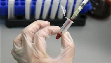 South African 9-year-old in rare HIV remission for years - without drugs