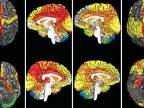 Females have significantly more active brains than men. Study claims: Women really DO overthink things