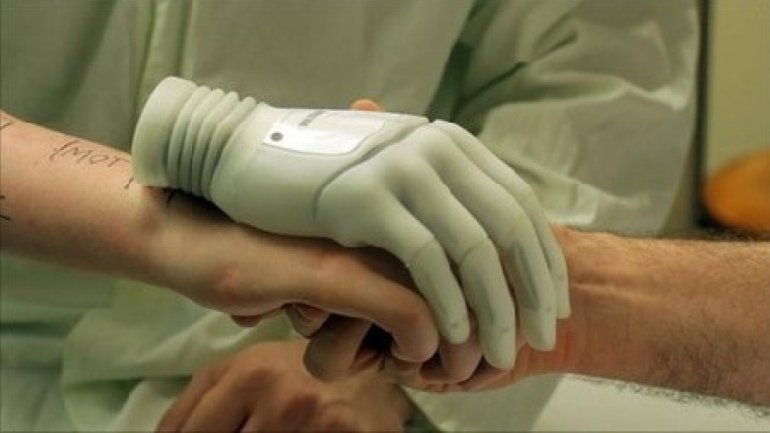 Young engineer from Capital offers 3D printed prosthesis for disabled people