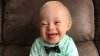 First baby with Down syndrome wins Gerber baby contest