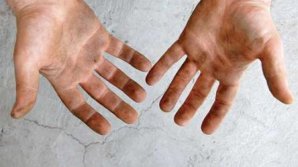 Hepatitis outbreak in Leova. New information regarding the 12 children