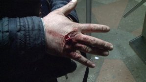 Bar Brawl in Capital. One man ended up with a broken arm