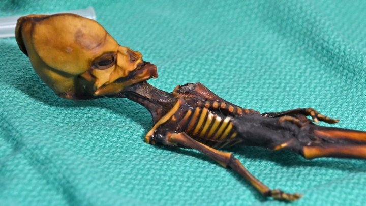 DNA tests proved that skeleton named Ata, considered to be alien, is a human