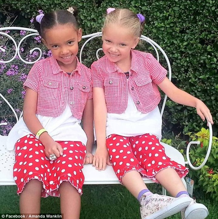 Striking set of twins born with different skin colors - one black and one white- are speaking out on their unique 'one-in-a-million' story