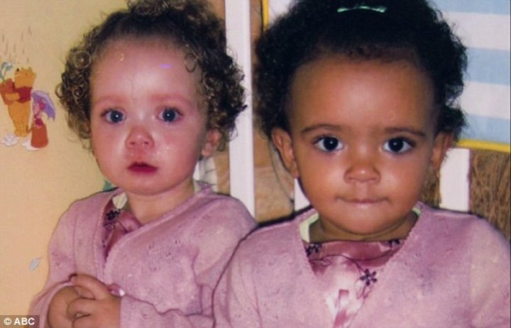 Striking set of twins born with different skin colors - one black and one white- are speaking out on their unique 'one-in-a-million' story