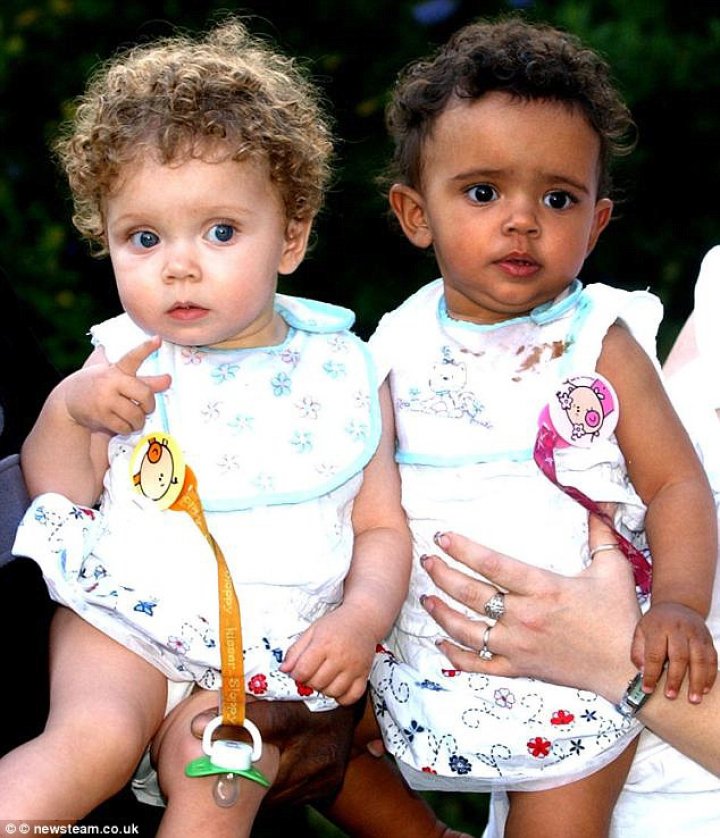 Striking set of twins born with different skin colors - one black and one white- are speaking out on their unique 'one-in-a-million' story