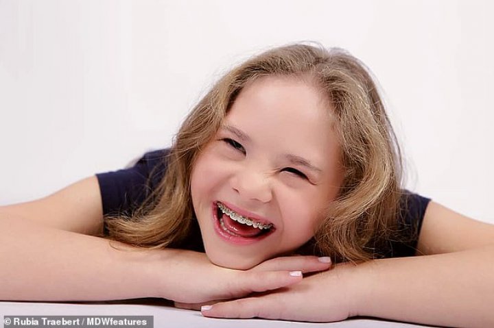 Never say never. History of young model with Down's syndrome