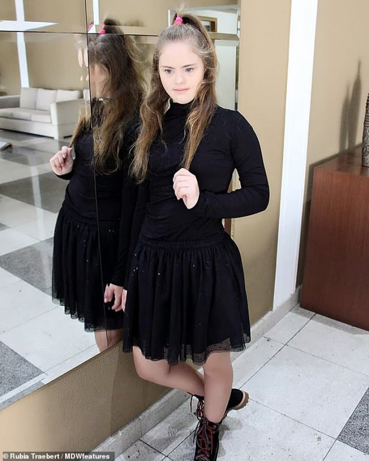 Never say never. History of young model with Down's syndrome