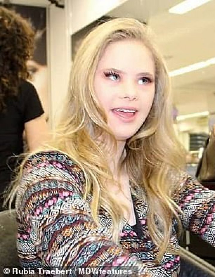 Never say never. History of young model with Down's syndrome