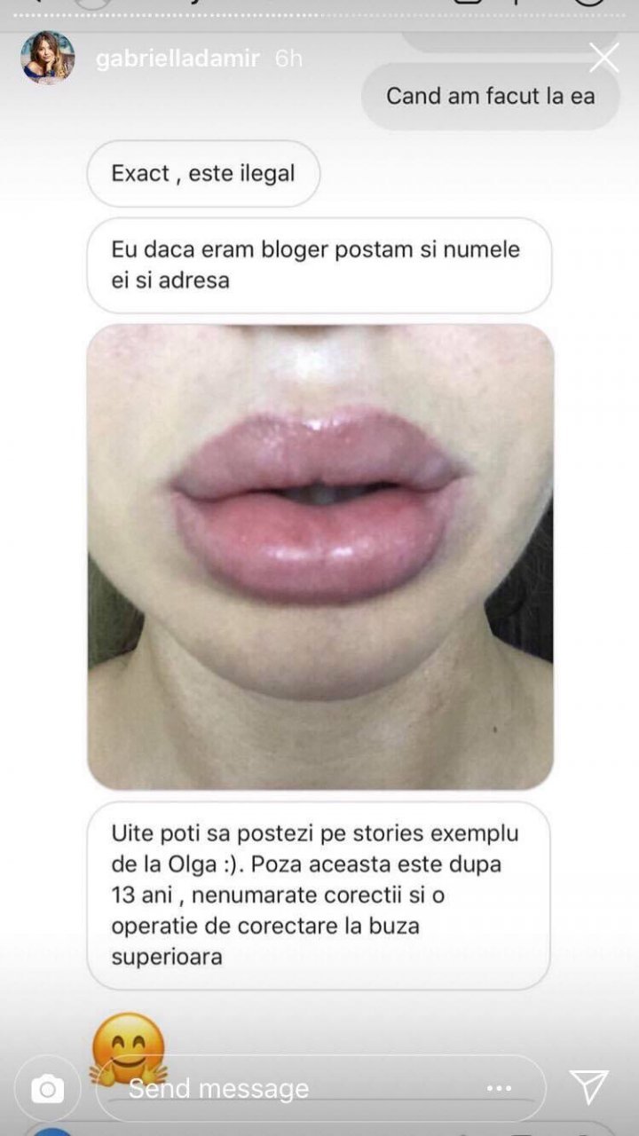 Nightmare of many Moldovans that wanted bigger lips