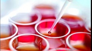 Cercetătorii americani au realizat nişte celule care pot împiedica HIV să infecteze organismul 