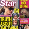 Star Magazine: Gemenii Angelinei Jolie suferă de sindromul Down