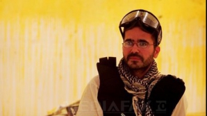 Artistul care şi-a montat o cameră video în ceafă este nevoit să o scoată 