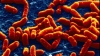 Bacteria E.Coli provoacă panică în Europa. AFLĂ în ce țări a ajuns infecția