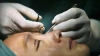 Sute de chinezi recurg la intervenţii chirurgicale pentru "europenizarea" ochilor