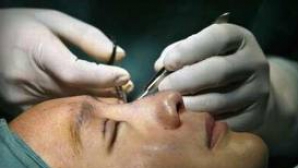 Sute de chinezi recurg la intervenţii chirurgicale pentru "europenizarea" ochilor