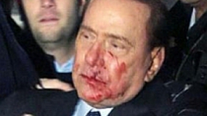 Silvio Berlusconi s-a ales cu o traumă la cap, după ce a alunecat la duş 
