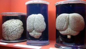 Cea mai mare colecţie de creiere din lume, deteriorată