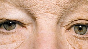 ULUITOR! Partea stângă a feţei unui bărbat a îmbătrânit de la expunerea prelungită la soare FOTO