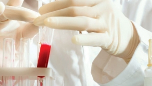 A fost descoperit un nou tip de SIDA. Boala îi afectează deja pe asiatici  