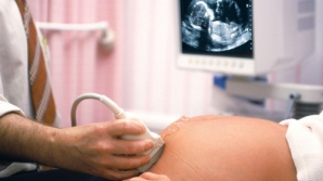 AVORT GRATUIT pentru minore în Franţa