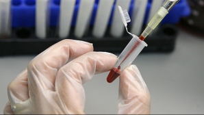 Un simplu test de sânge ne poate spune cât mai avem de trăit 