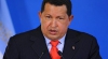 Preşedintele Venezuelei, Hugo Chavez, a trecut cu bine de o intervenţie chirurgicală complicată 