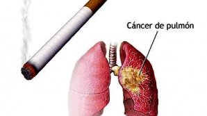 Cancerul pulmonar, principala cauză a deceselor în rândul femeilor din Europa