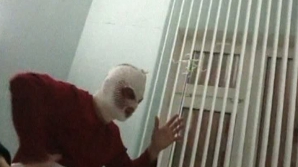 Poliţia din Rusia are un suspect, după ce directorul artistic al Teatrului Bolşoi a fost stropit cu acid pe faţă 