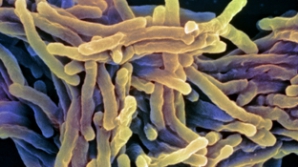 "Aproximativ 30 la sută din cazurile de tuberculoză din Europa de Est şi Asia Centrală nu pot fi tratate" 