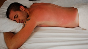 Cele mai bune metode prin care poţi linişti o arsură solară dureroasă