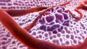 A fost descoperit un nou medicament care ar putea trata cancerul