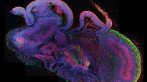 Reuşită fără precedent! Specialiştii austrieci au creat creiere umane în miniatură